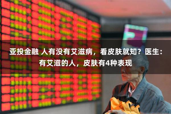 亚投金融 人有没有艾滋病，看皮肤就知？医生：有艾滋的人，皮肤有4种表现